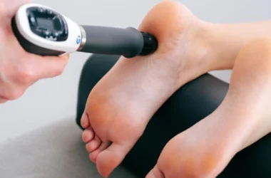 Fascitis plantaris shockwave
